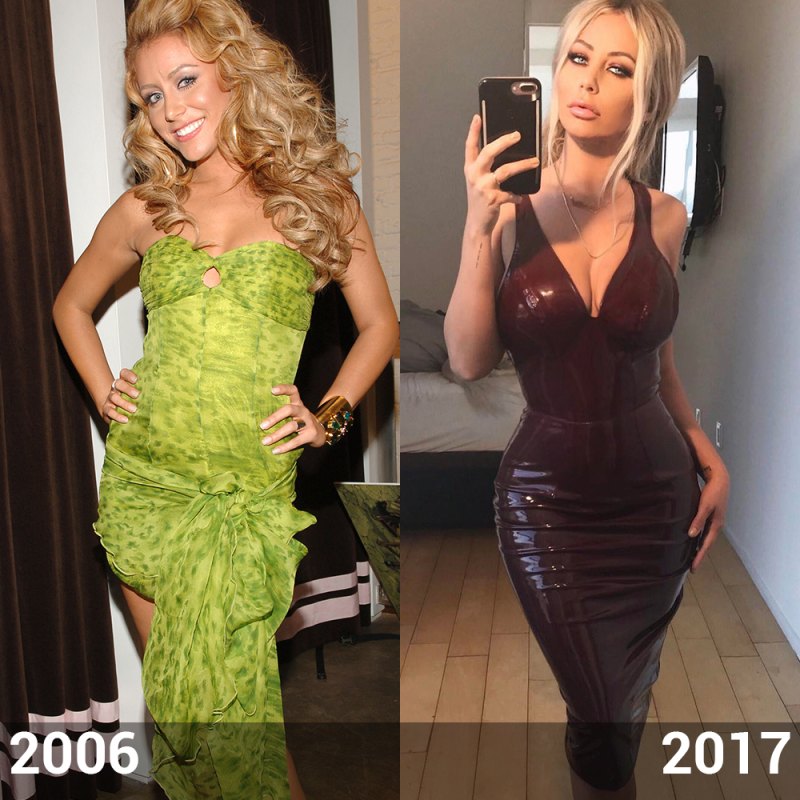 Aubrey oday before plastic surgery silhouette