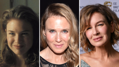 Did Renee Zellweger Get Plastic Surgery? Transformation Photos