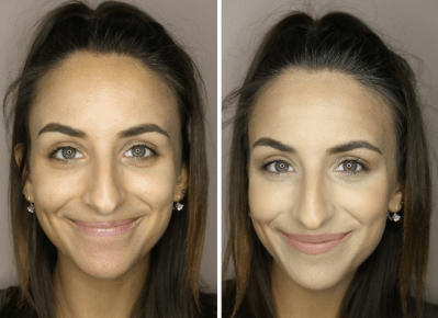 how to get rid of under eye circles 8 how to get rid of under eye circles 8
