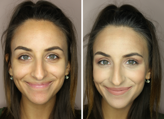 how to get rid of under eye circles 8