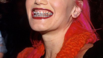 Gwen stefani braces