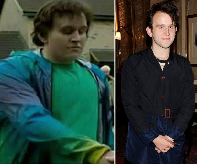 Harry melling fat suit