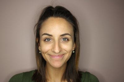 how to get rid of under eye circles 1