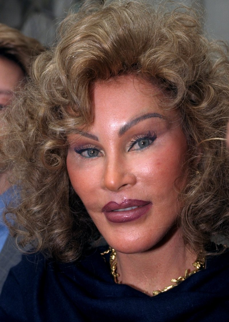 Jocelyn wildenstein april 1999