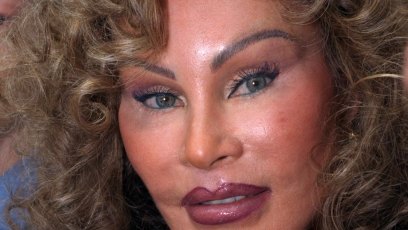 Jocelyn wildenstein april 1999