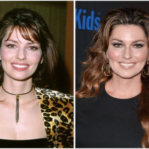 Shania twain plastic surgery