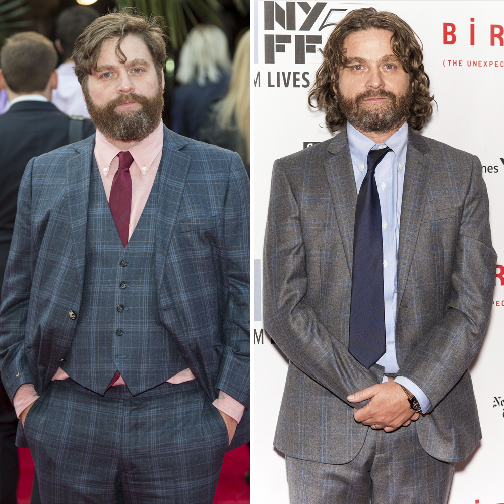 Zach galifianakis weight loss 31