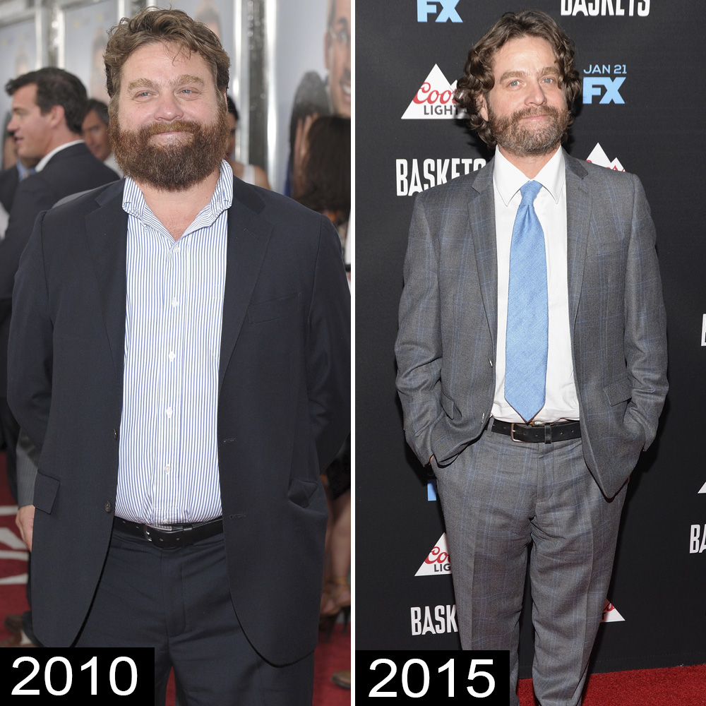 Zach galifianakis weight loss