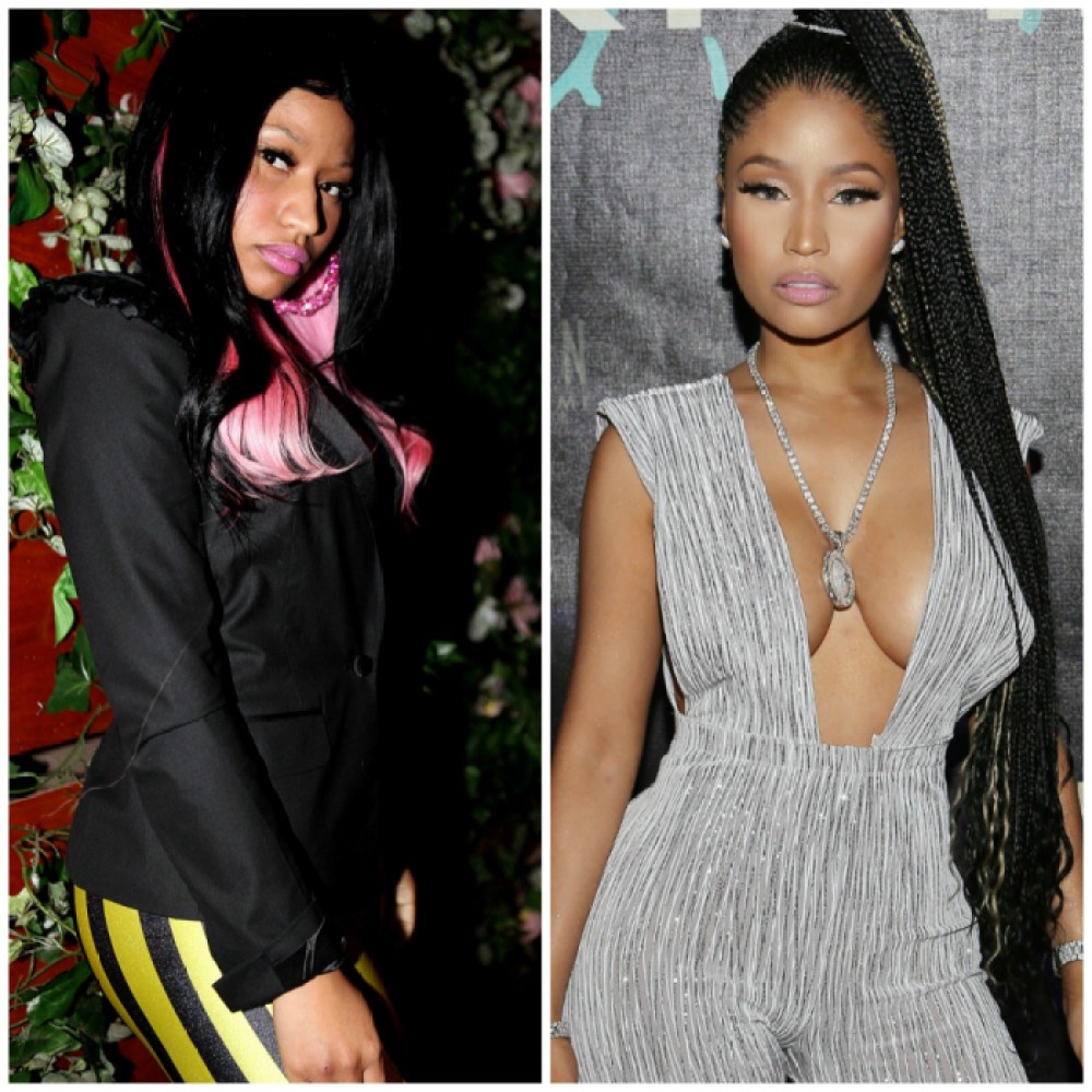 Nicki Minaj Free Porn - See Nicki Minaj Before and After Butt Implants and Nose Job Rumors