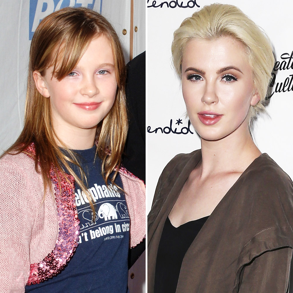 Ireland baldwin 7
