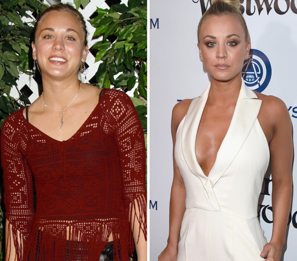 Kaley Cuoco Tits Porn - Kaley Cuoco Breast Implants: See Her Plastic Surgery Transformation