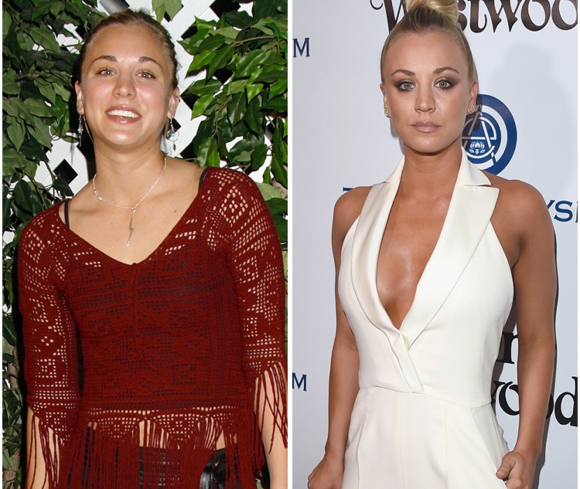 kaley-cuoco-breast-implants-see-her-plastic-surgery-transformation