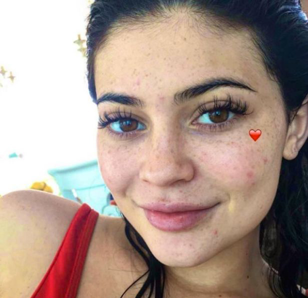 kylie jenner freckles