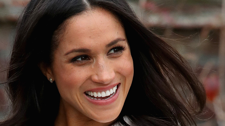 Meghan markle nose job
