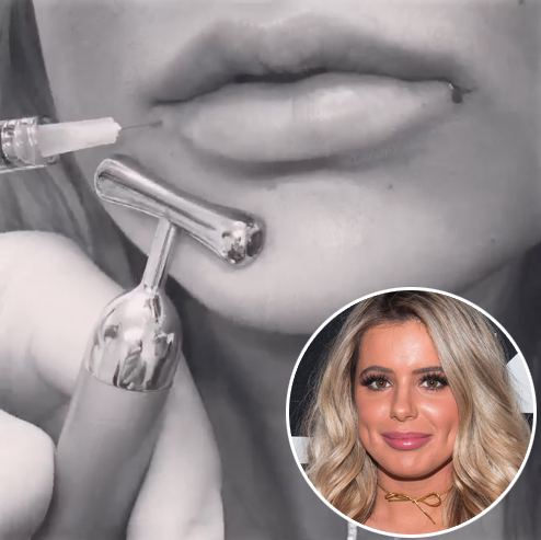 Brielle zolciak lip injections