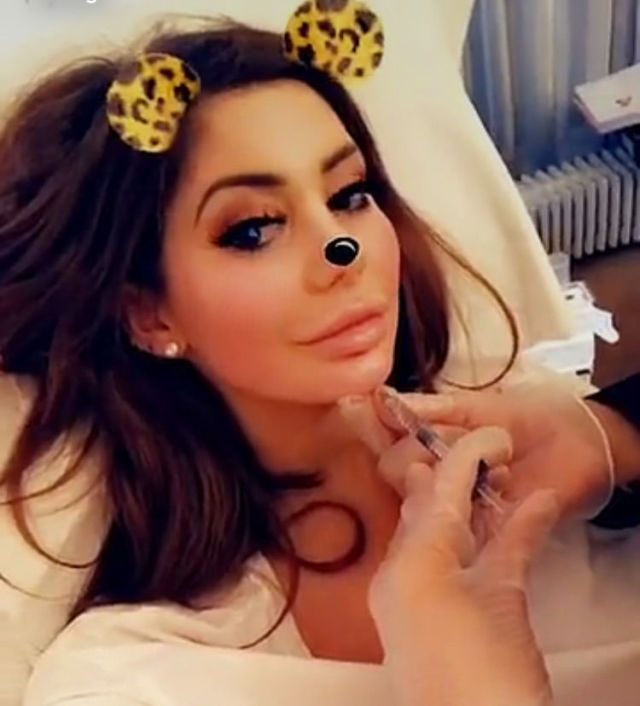 Chloe ferry new chin