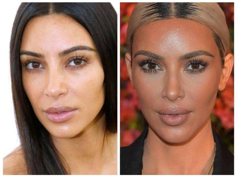 Kim Kardashian Before And After Plastic Surgery Timeline Kim Kardashian Before And After Plastic Surgery Timeline