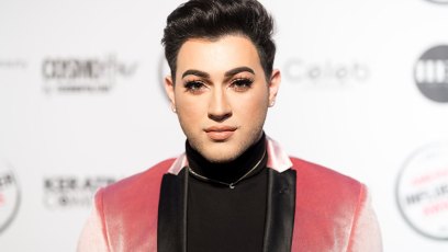 Manny mua vitiligo