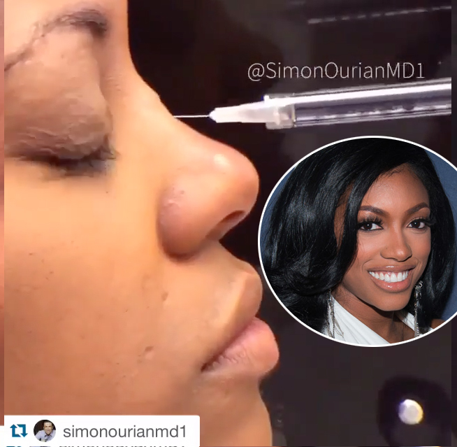 Porsha williams nose job 2