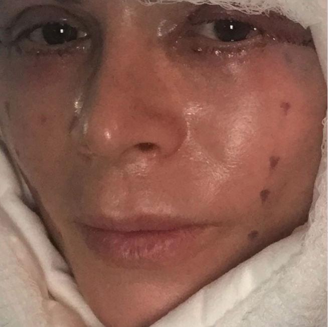 Tamra judge facelift