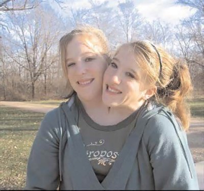 Conjoined twins Abigail and Brittany Hensel take in the sights of