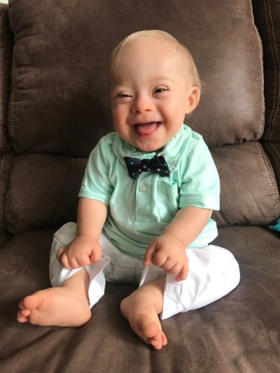 gerber baby with down syndrome gerber baby with down syndrome