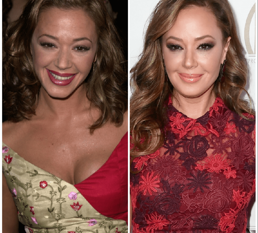 leah remini plastic surgery Image 4