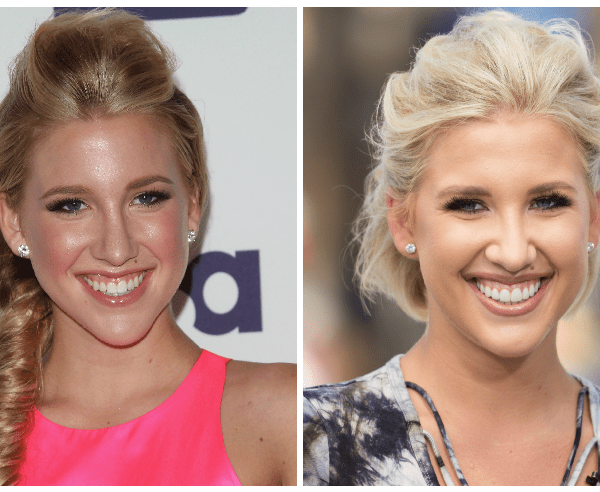 savannah chrisley plastic surgery Image 3