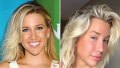 savannah-chrisley-plastic-surgery
