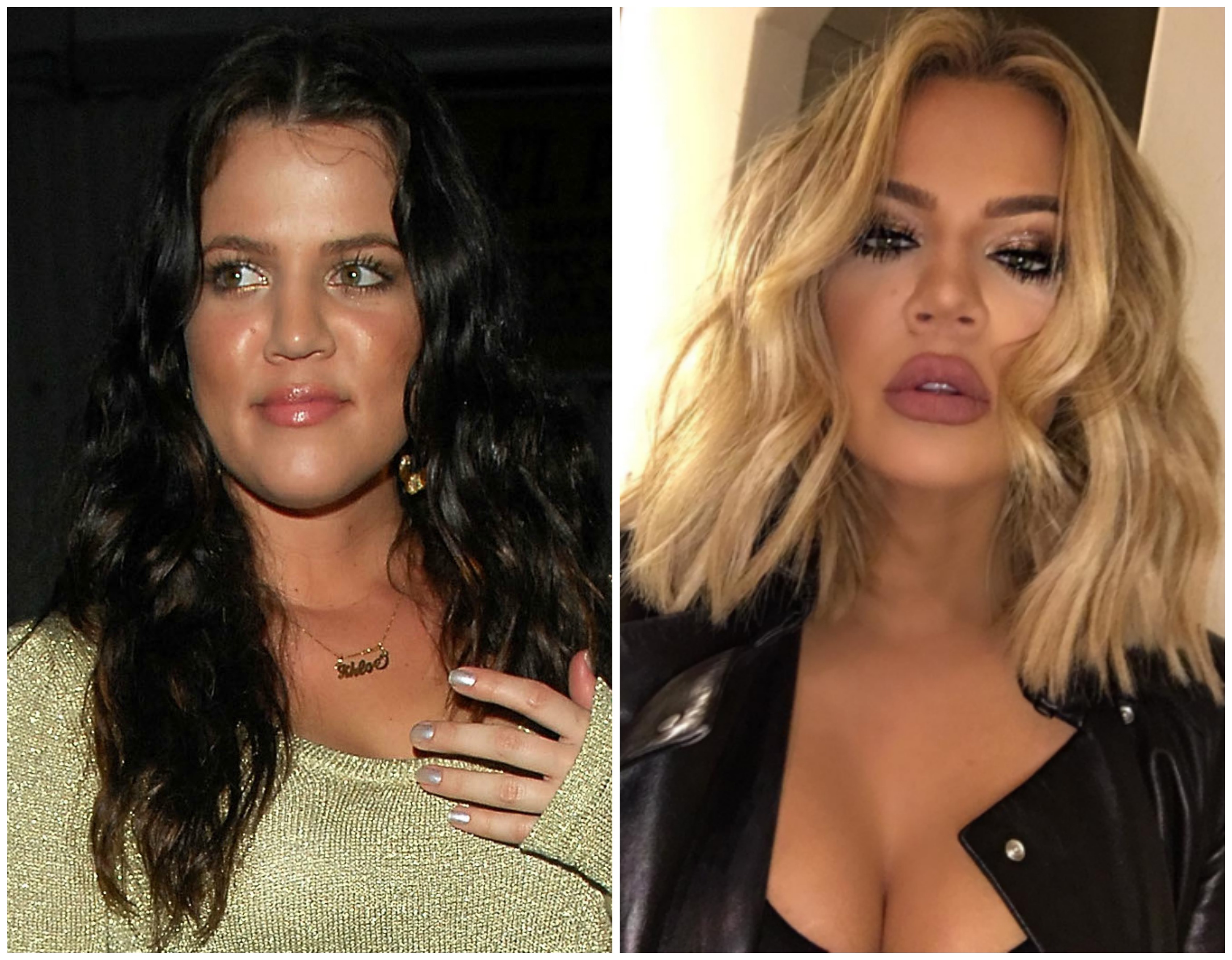 khlo&eacute; kardashian before and after face