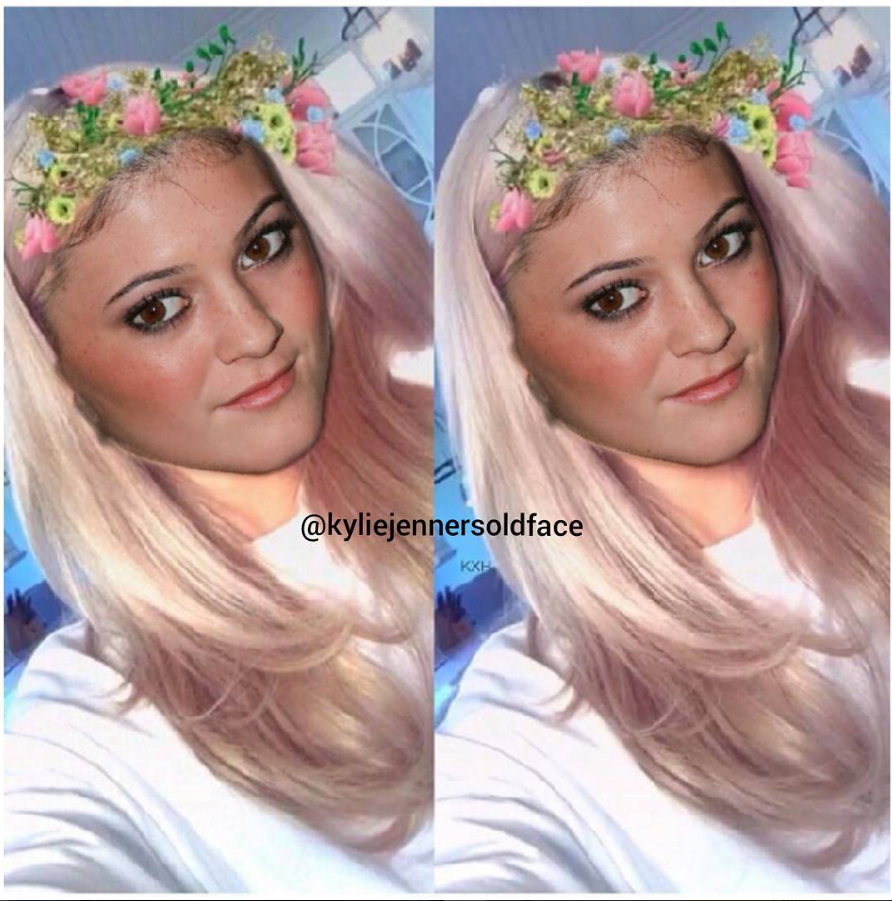 Kylie jenner old face 2