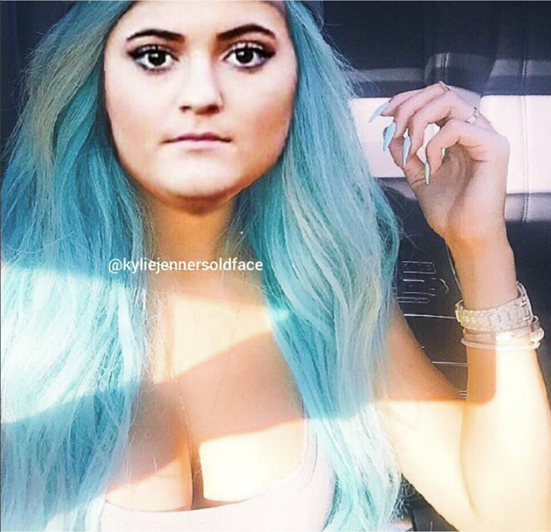 Kylie jenner old face 8