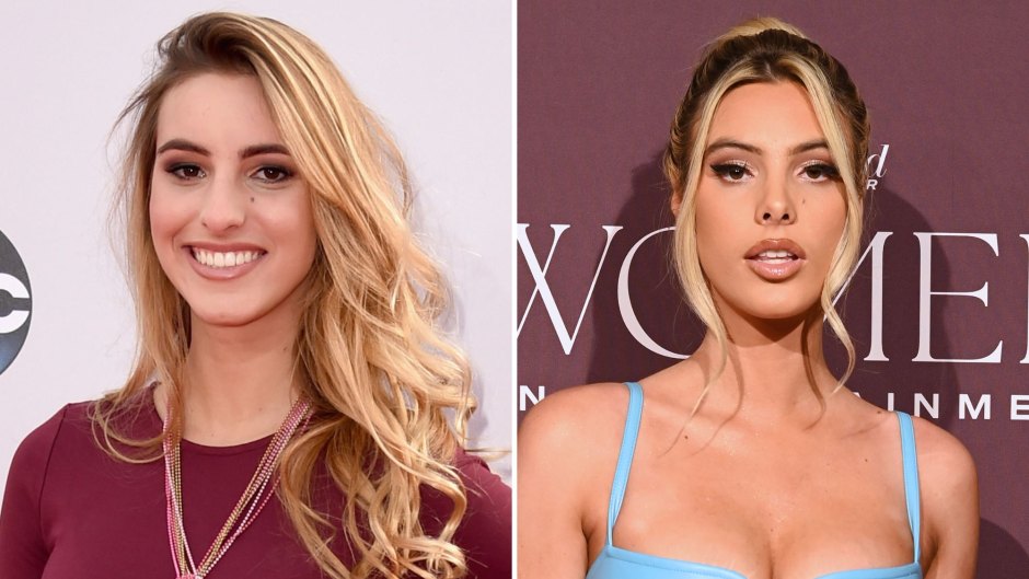 Lele Pons Plastic Surgery: See the YouTube Star's Transformation