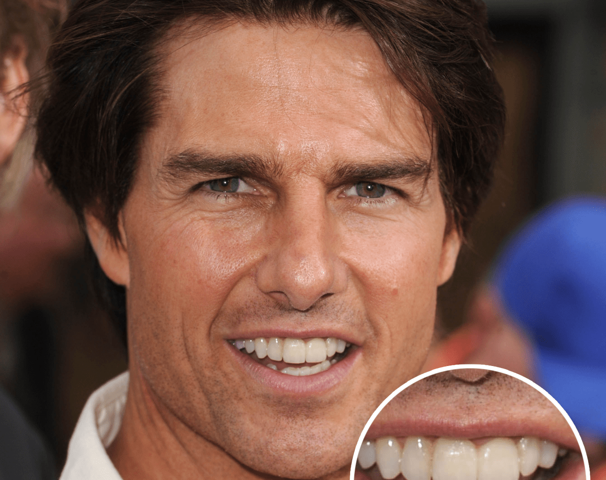 tom cruise teeth photos