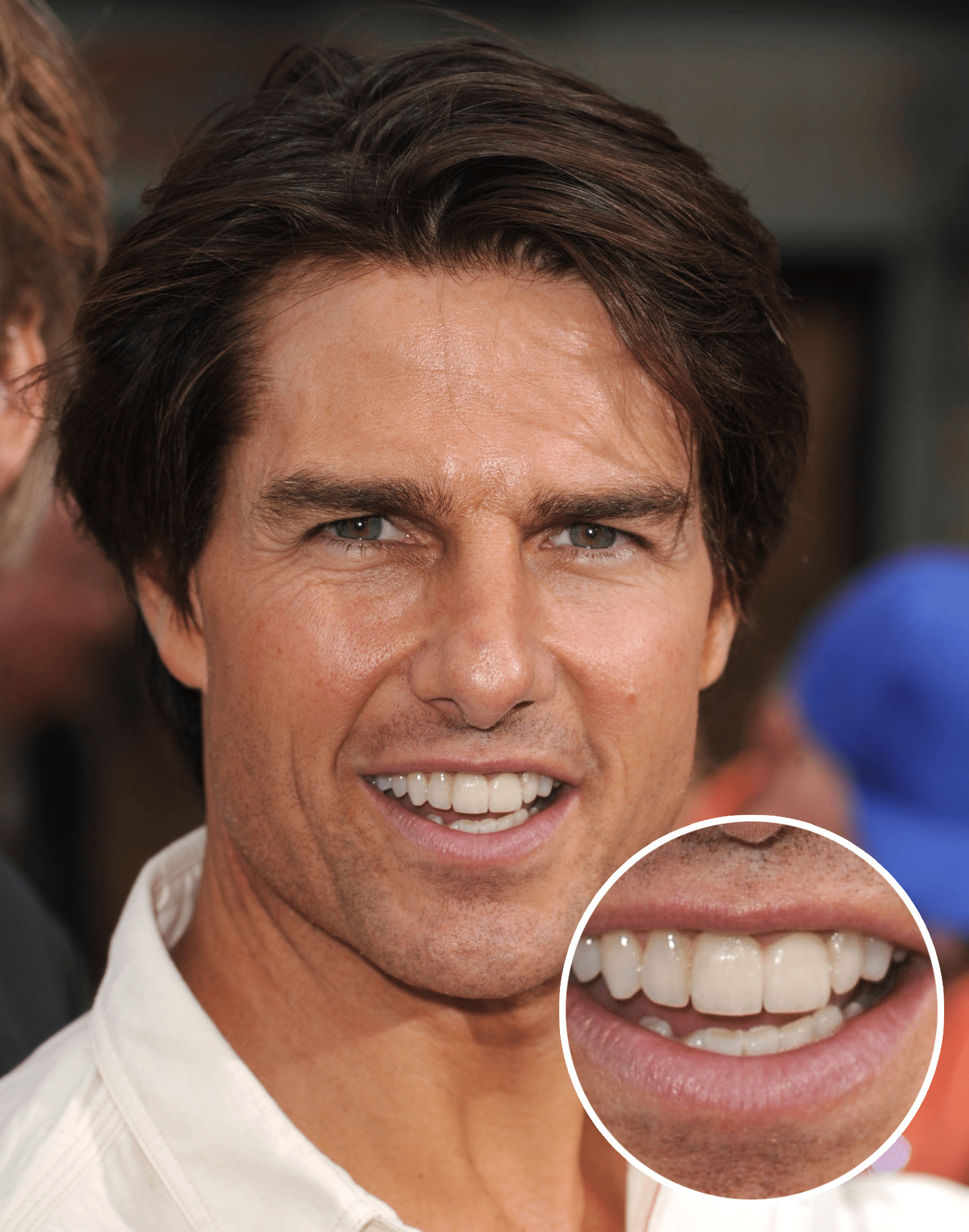 Tom Cruise'S Middle Tooth — The Story Behind His Smile
