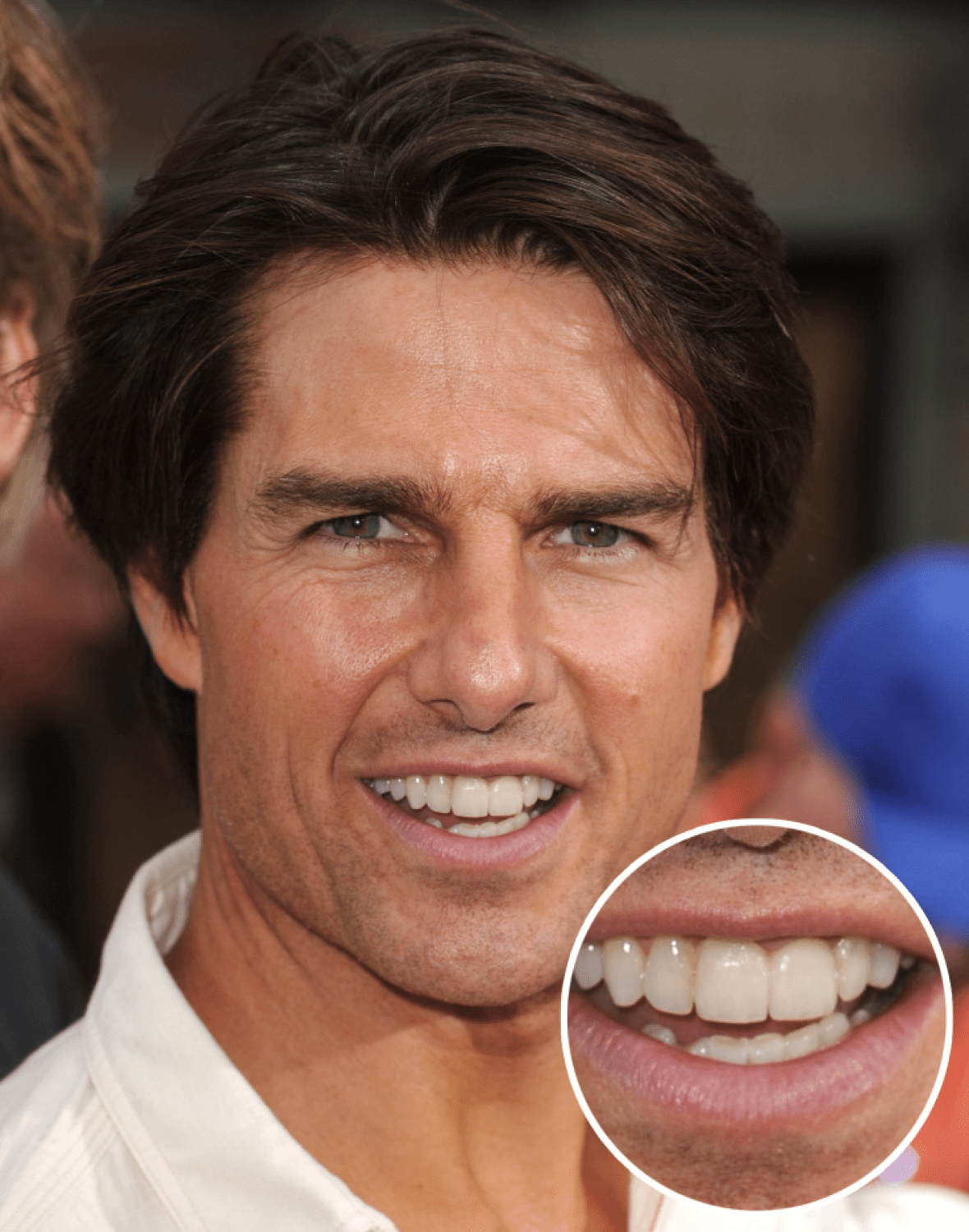 tom cruise tooth midline