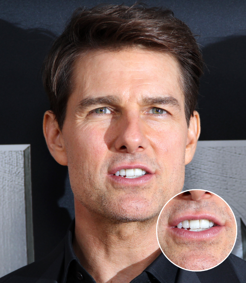 tom cruise tooth cocktail