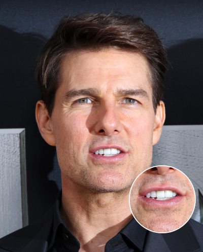 tom cruise front tooth