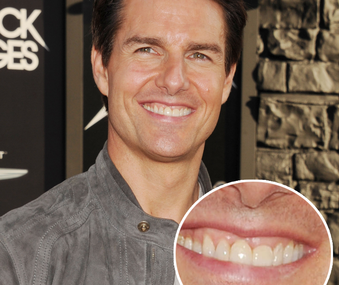 Tom Cruise One Big Tooth