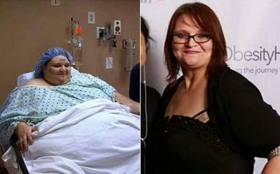 melissa morris before/after