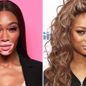 Winnie-Harlow-Tyra-Banks