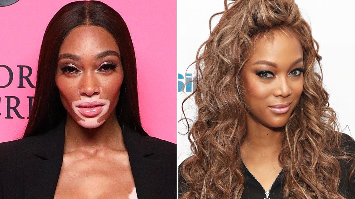 Winnie-Harlow-Tyra-Banks