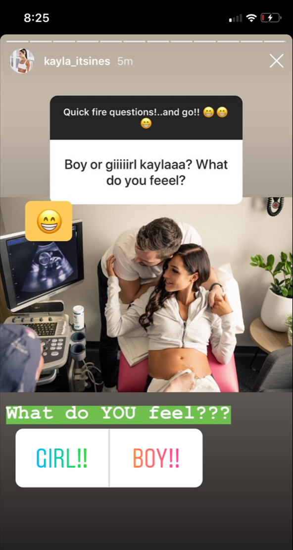 kayla-itsines-pregnancy-ig-q&a