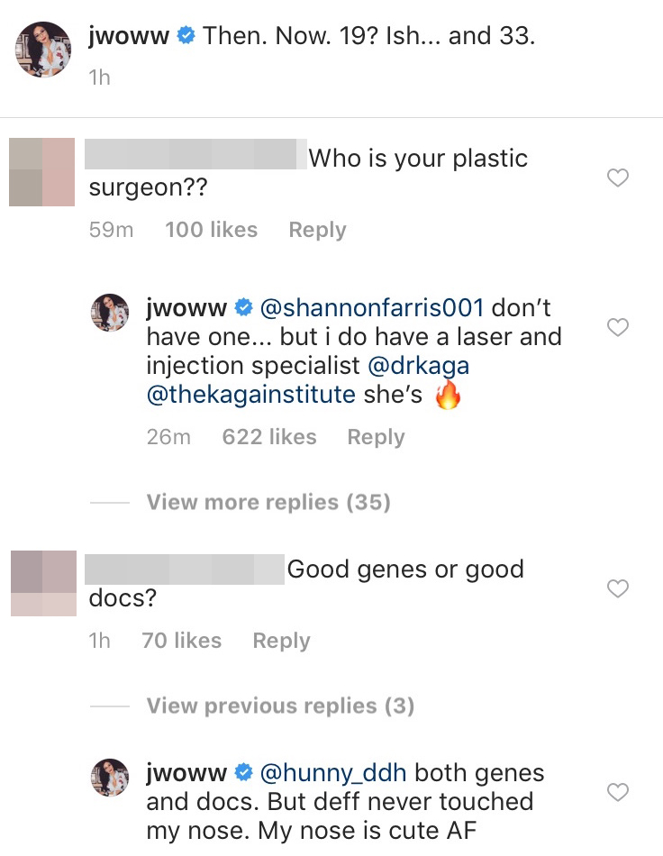 Jersey Shore’ Star JWoww Sets The Record Straight About What Procedures She’s Done To Her Face