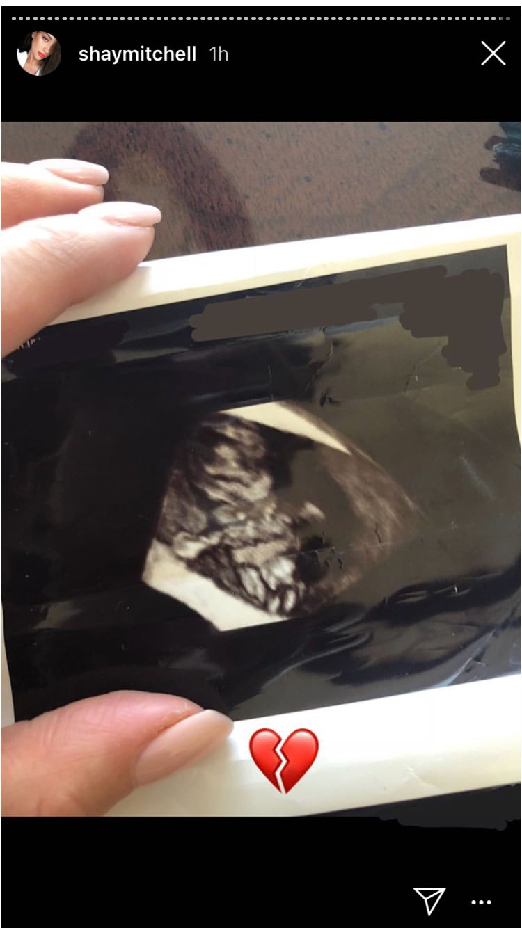 Shay Mitchell's sonogram