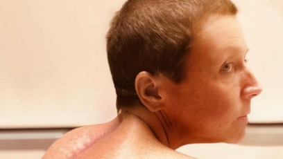 Abby Lee Miller, Spinal Surgery, Instagram post