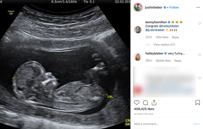 Hailey Baldwin Comments On Justin Bieber Pregnancy Prank