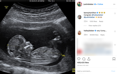 Hailey Baldwin Comments On Justin Bieber Pregnancy Prank
