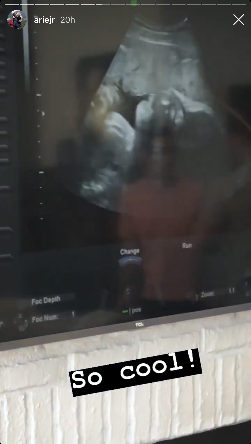 bachelor-arie-luyendyk-lauren-burnham-baby-shower