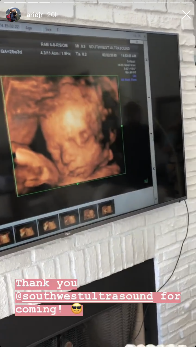 bachelor-arie-luyendyk-lauren-burnham-baby-shower